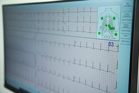 Echocardiogram | SmartCare Diagnostics | Springfield & Mt. Gravatt
